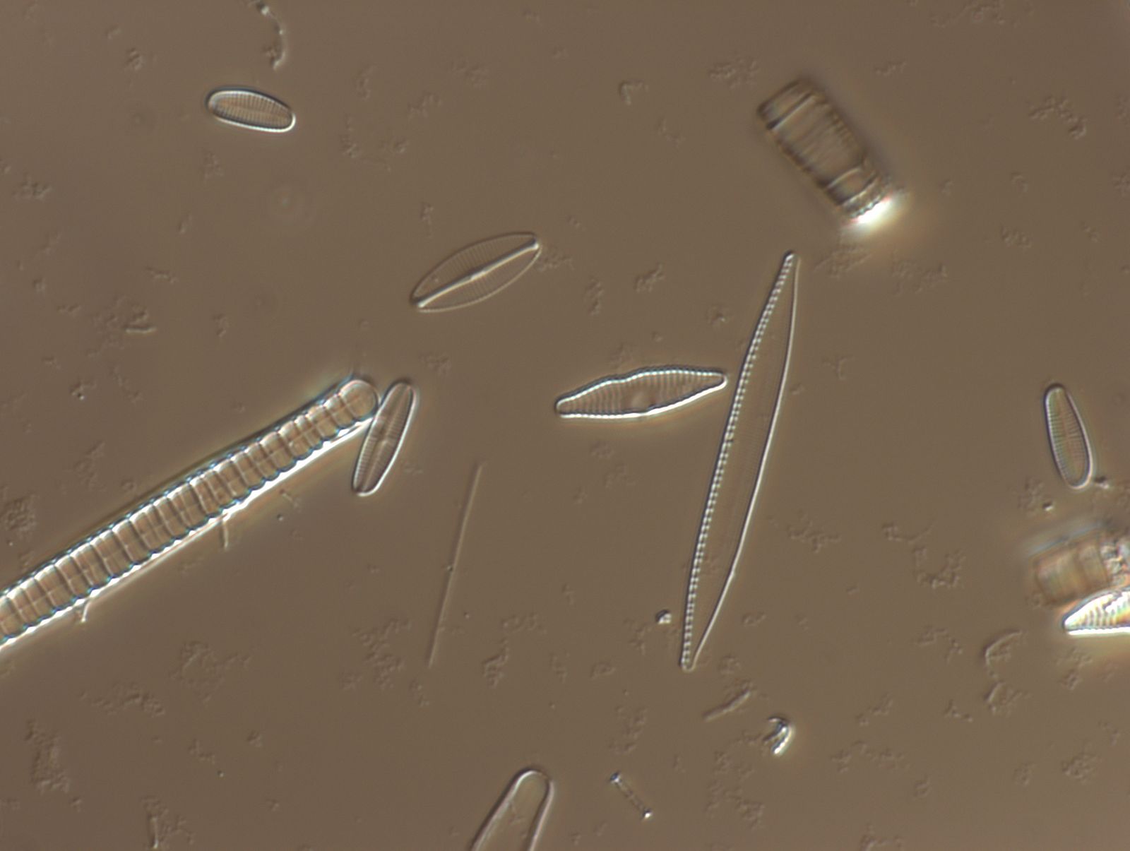 scimabio-interface, expertises, ADNe invantaire diatomée, ADN environnemental, indice de qualité,IBD, IPS, MetaDIA, métabarcoding. photo de frustules de diatomées.