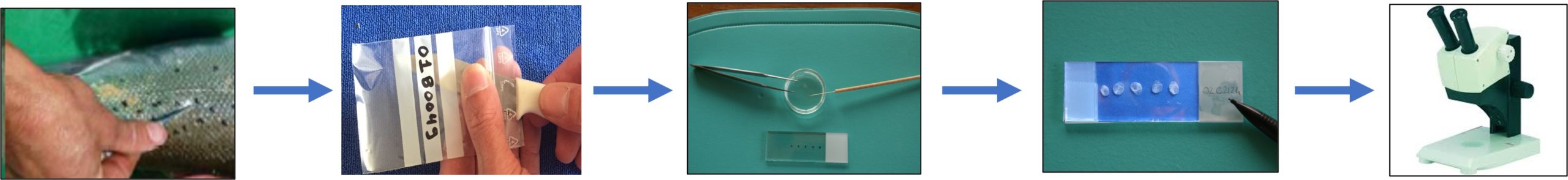 Illustration des différentes étapes du prélèvement à la lecture sous binoculaire